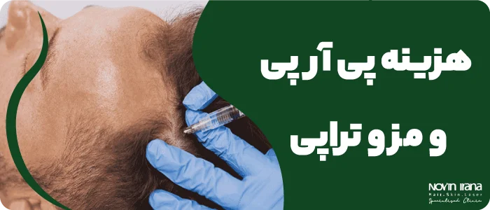 هزینه پی آر پی و مزو تراپی